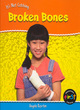 Image for It&#39;s Not Catching: Broken Bones Hardback