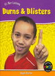 Image for Burns &amp; blisters