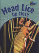 Image for Head lice up close