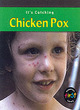 Image for It&#39;s Catching: Chicken Pox Paperback