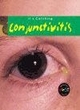 Image for It&#39;s Catching: Conjunctivitis