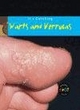 Image for It&#39;s Catching: Warts and Verrucas Hardback