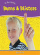 Image for Burns and blisters