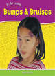 Image for It&#39;s Not Catching: Bumps And Bruises Paperback