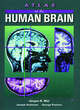 Image for Atlas of the Human Brain