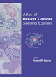 Image for Atlas of Breast Cancer