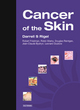 Image for Cancer of the Skin