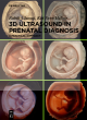 Image for 3D Ultrasound in Prenatal Diagnosis