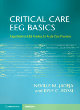 Image for Critical care EEG basics  : rapid bedside EEG reading for acute care providers