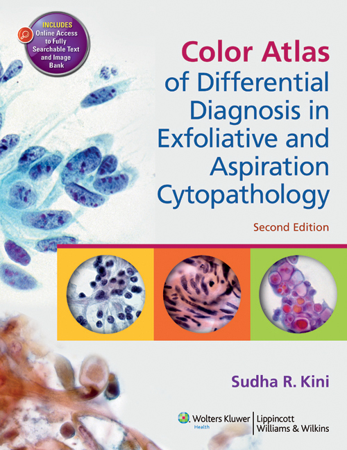 Color Atlas of Differential Diagnosis in Exfoliative and Aspiration Cytopathology by Kini, Sudha ...