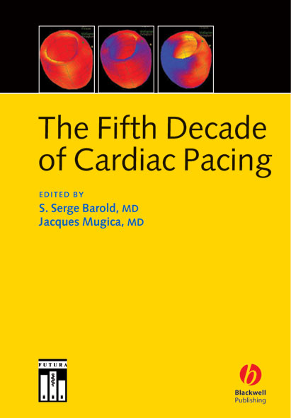 The Fifth Decade of Cardiac Pacing by Barold, S. Serge (Rochester ...